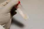 Un análisis de semen puede mejorar la detección del cáncer de próstata Un doctor sosteniendo un tubo con una muestra de semen para analizar