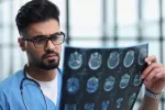 Revelan el papel clave de la molécula NAD en el envejecimiento Un médico examina imágenes del cerebro con patología neurodegenerativas