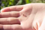 Identifican un nuevo virus en pacientes chinos transmitido por garrapatas Una persona mostrado una garrapata con la mano extendida