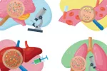 Los microplásticos se acumulan sobre todo en el cerebro Ilustraciones del cerebro, hígado, sangre y pulmones con microplásticos