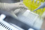 Un nuevo test detecta el alzhéimer 10 años antes que un escáner cerebral Un científico realizando un test basado en biomarcadores
