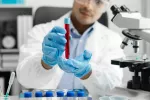 Un nuevo análisis de sangre identifica precozmente un agresivo tumor de páncreas Médico sostiene un tubo de ensayo con sangre en un laboratorio