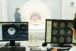 Relacionan cambios en una estructura cerebral con disfunciones cognitivas pos-COVID Médico observa la pantalla del ordenador mientras hace una resonancia magnética a una paciente