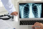 Identifican una diana terapéutica para combatir el adenocarcinoma de pulmón Médicos estudian una imagen radiológica de los pulmones