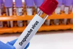 Asocian fenómenos climáticos extremos con el brote de Oropouche en América Latina Sanitario sostiene vial con sangre para analizar virus de Oropouche