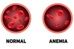 Estar anémica en las primeras semanas de embarazo puede aumentar el riesgo de cardiopatía en el bebé Ilustración de sangre de una persona sana y otra con anemia