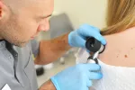 Utilizan el citomegalovirus para mejorar el tratamiento del cáncer de piel melanoma Un dermatólogo examina posibles lesiones malignas en la piel de una paciente con un dispositivo dermatoscópico