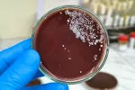 Los patógenos resistentes a antibióticos aumentarán si no se frena el cambio climático La mano de un científico sujeta un cultivo microbiológico de un patógeno resistente a los antimicrobianos