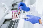 Un análisis de sangre puede detectar varios tipos de cáncer en etapas iniciales Un investigador sujeta un soporte con varios tubos de ensayo con sangre en un laboratorio
