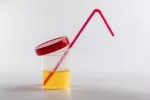 Beber orina para mejorar la salud Bote de orina con la tapa abierta y una pajita de plástico roja dentro