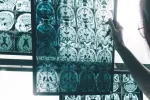 Imágenes de resonancia magnética para identificar signos de alzéimer Doctora estudia imágenes de resonancia magnética del cerebro