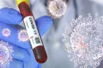 Muestra de sangre infectada por el coronavirus SARS-CoV-2 Sanitario sostiene un tubo de ensayo con sangre y la etiqueta que indica positivo al COVID