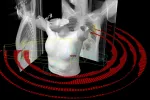 Paciente de cáncer de mama radiada Imagen 3D de un tratamiento radioterápico en paciente con cáncer de mama