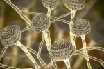 Hongo aspergillus flavus, que podría ser útil contra el cáncer Hongos Aspergillus, que pueden causar infecciones pulmonares