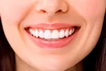 Detección de párkinson mediante la sonrisa Una mujer con una sonrisa con dientes blancos