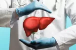 Concepto de cáncer de hígado por factores prevenibles Un hepatólogo muestra entre sus manos la imagen de un hígado enfermo