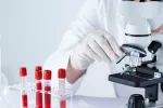 Tubos de ensayo contienen sangre para ser examinada en busca de signos de cáncer Científica examina sangre en un microscopio en el laboratorio