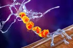 Neuronas motoras deterioradas a causa de esclerosis lateral amiotrófica Ilustración en 3D de neuronas motoras degradadas por ELA
