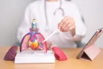 Investigación para abordar la fibrosis pulmonar idiopática Médico apunta a un pulmón enfermo con fibrosis pulmonar idiopático
