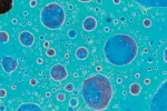 Células cancerosas, investigan para provocar su autodestrucción Células cancerosas