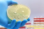 Bacterias que muestran resistencia al tratamiento con antibióticos Cultivo microbiológico de Petri con bacterias para hacer prueba de resistencia a antibióticos