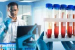 Científico analiza muestras de sangre de pacientes de ELA Investigador junto a frascos que contienen sangre en un laboratorio