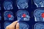 Médico revisa resonancias magnéticas del cerebro y tumores cerebrales
