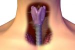 Diagnóstico del cáncer de laringe
