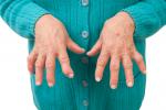 Edad avanzada, causas de la artritis reumatoide 