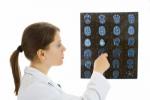 Doctora mirando una radiografía del cerebro