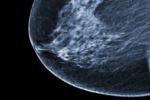 Ecografía de la mama con tumor