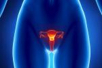 Histerosalpingografía, salud en el útero