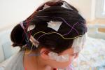 Diagnóstico de la epilepsia con EEG