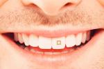 Persona sonriendo mostrando el chip implantado