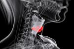 Ilustración 3d del cáncer de tiroides