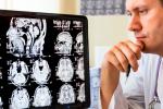 Médico visualizando un daño en el cerebro en unas radiografías