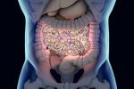El microbioma intestinal, implicado en la esclerosis múltiple