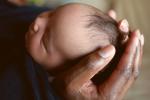 Asocian sufrir virus Zika en el embarazo con microcefalia
