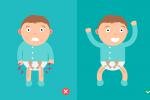 Ilustración que muestra el efecto de la displasia en bebés