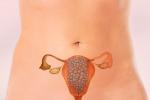 Embarazada con mola hidatiforme, una complicación de la gestación
