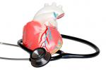 Qué es el infarto de miocardio