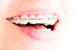 Qué es una ortodoncia