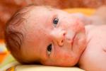 Sudamina, consejos para evitar su aparición en bebés
