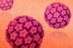 Qué es la infección por VPH