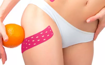 Slim taping Slim taping para combatir la celulitis