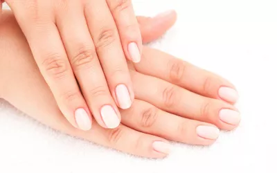 Manchas en las uñas afección Las manchas en las uñas pueden indicar una afección