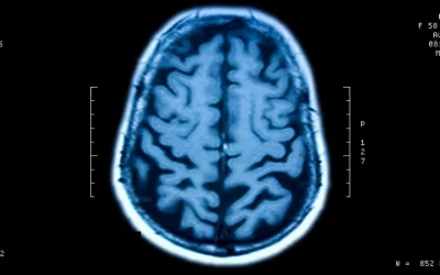 Lesión cerebral Orientarse y sortear obstáculos es posible para los lesionados cerebrales con pérdida de visión