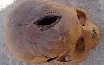 Craneo con trepanación Historia de la trepanación