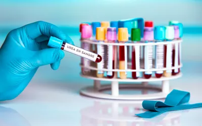 Urea en sangre en un tubo para analíticas
