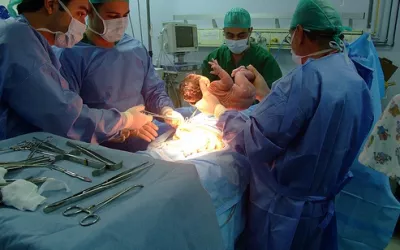 Equipo sanitario realizando una cesárea